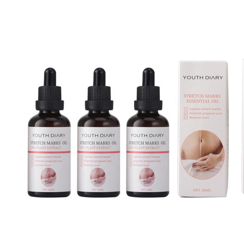 الزيت الطبيعي لإزالة علامات التمدد